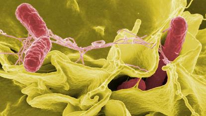 La «Salmonella typhimurium», en rouge, sur une culture de cellules humaines.