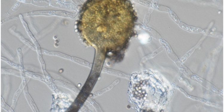 Aspergillus aculeatus