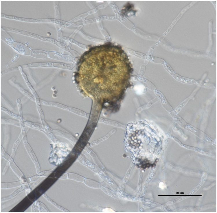 Aspergillus aculeatus